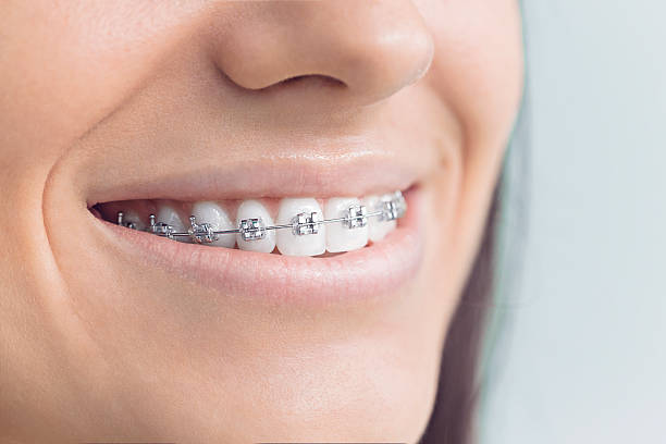 Dental Bonding in Okemah, OK